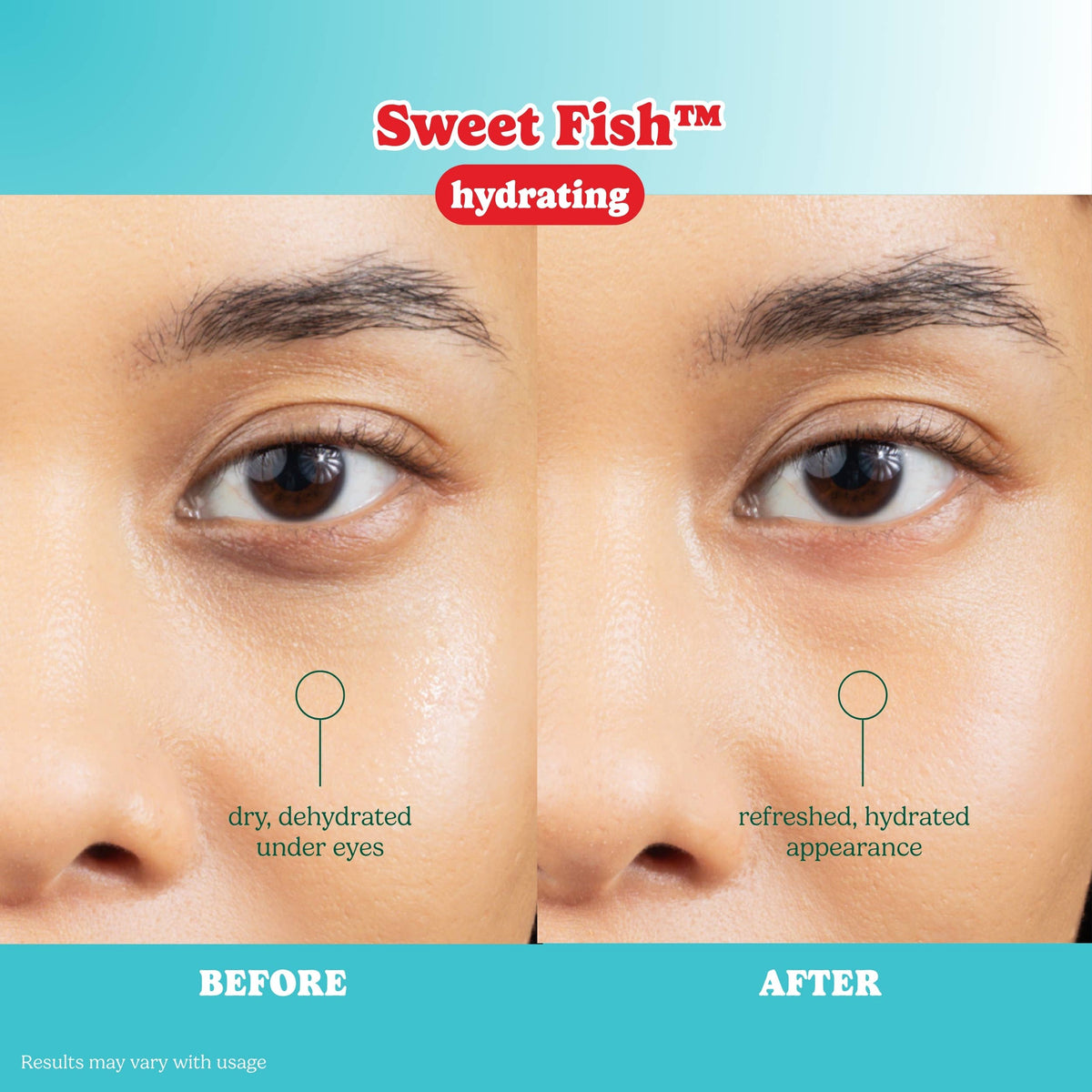 ESW x SmartSweets Hydrating Sweet Fish™ Eye Patches: 10 pc PDQ