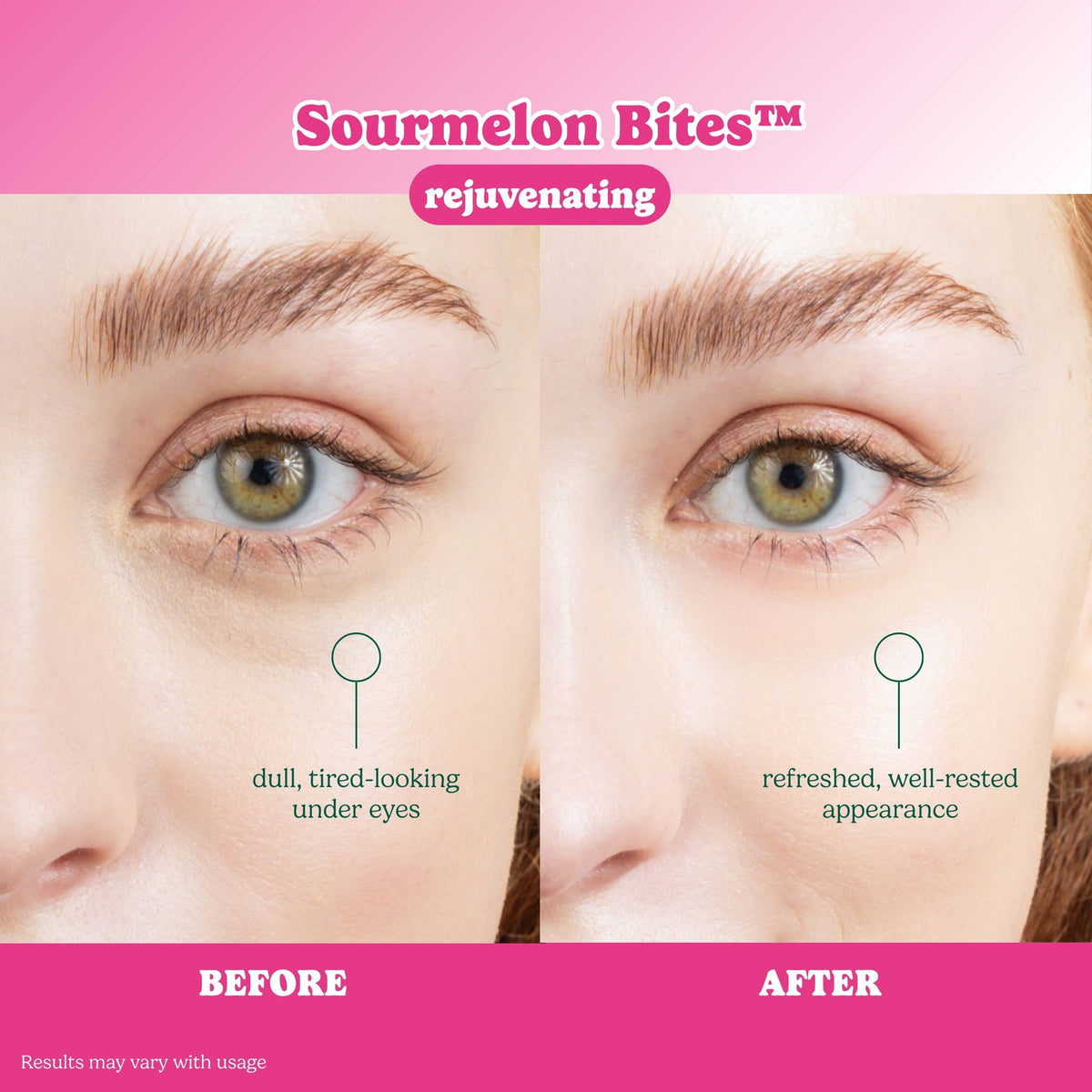ESW x SmartSweets Rejuvenating Sourmelon Bites™ Eye Patches: 10 pc PDQ
