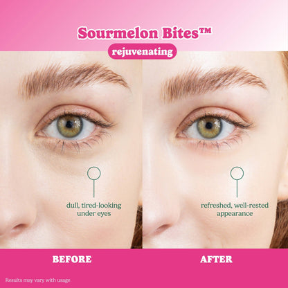 ESW x SmartSweets Rejuvenating Sourmelon Bites™ Eye Patches: 10 pc PDQ