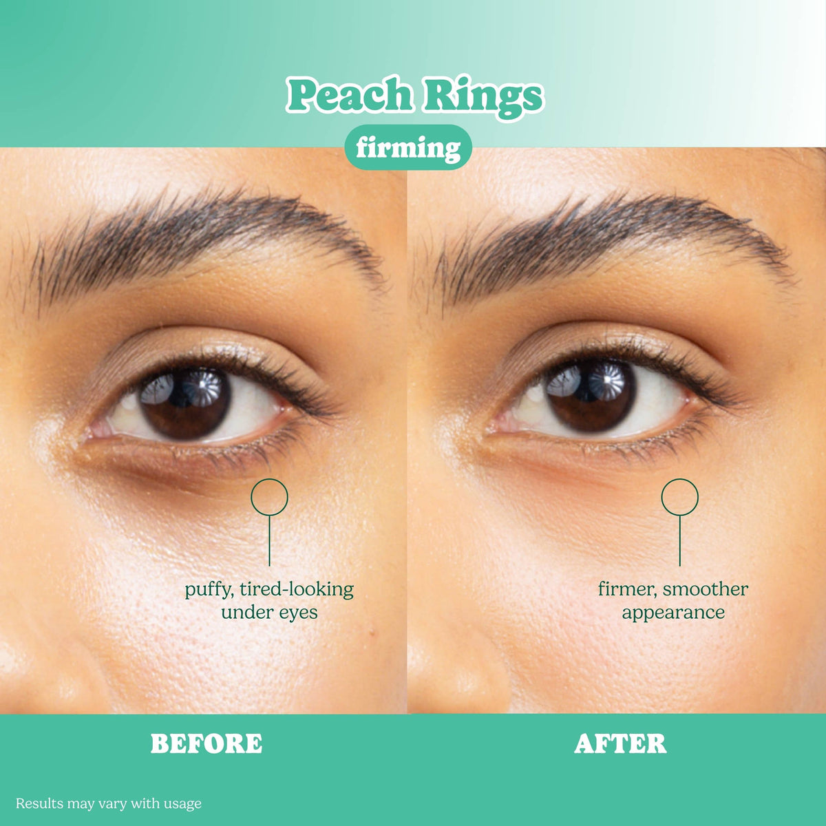 ESW x SmartSweets Firming Peach Rings Eye Patches: 10 pc PDQ