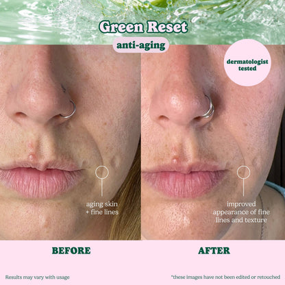 Green Reset Anti Aging Raw Juice Sheet Mask: With Peg Hole